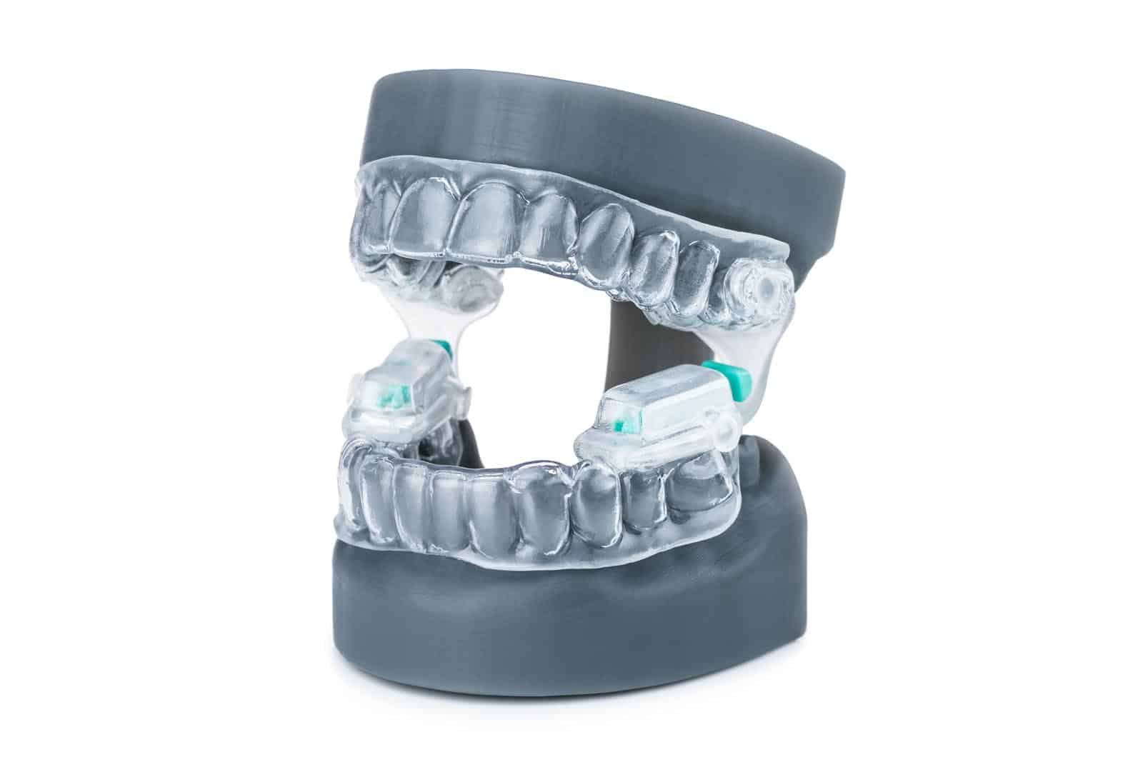 Snoreeze LabFit Oral Device: For the treatment of loud snoring and mild obstructive sleep apnoea Snoreeze Snoreeze LabFit Oral Device: For the treatment of loud snoring and mild obstructive sleep apnoea Snoreeze